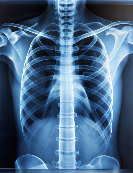This high-resolution X-ray reveals intricate details of the human chest, including bones of the ribcage, spine, and shoulders, suitable for medical study and diagnosis.